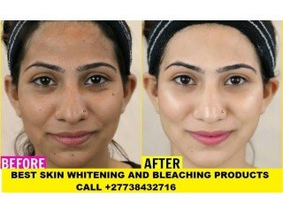 Permanent Skin Lightening Skin Whitening Products +27738432716