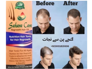 Sahara Care Regrowth Hair Oil in Quetta  03001819306