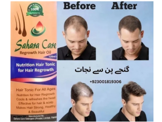 Sahara Care Regrowth Hair Oil in Peshawar  03001819306