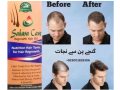 sahara-care-regrowth-hair-oil-in-lahore-03001819306-small-0