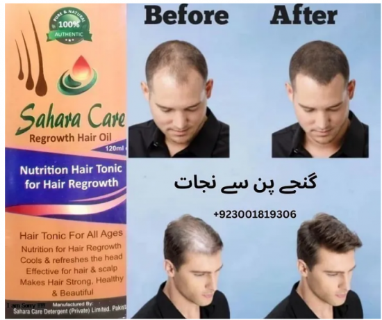 sahara-care-regrowth-hair-oil-in-lahore-03001819306-big-0