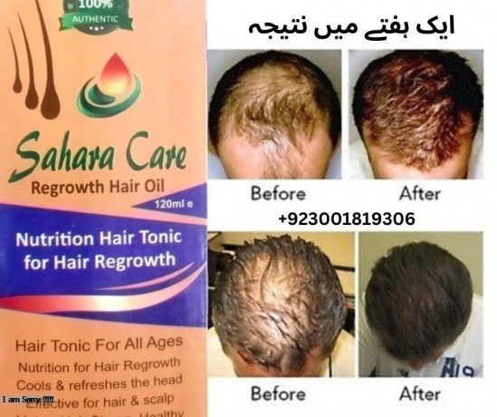 sahara-care-regrowth-hair-oil-in-gujranwala-923001819306-big-0